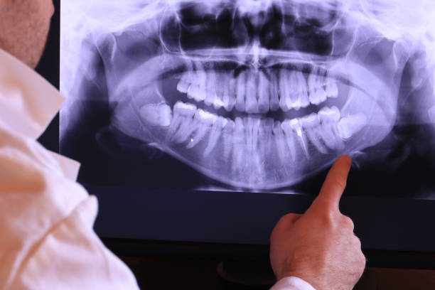 Best Chipped Tooth Repair Near Me  in Woodlands, CA